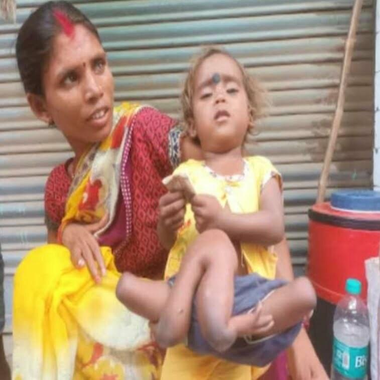 आश्चर्यजनक : बिहार के नवादा में चार हाथ और चार पैर वाली अद्भुत बच्ची बनी कौतूहल का विषय