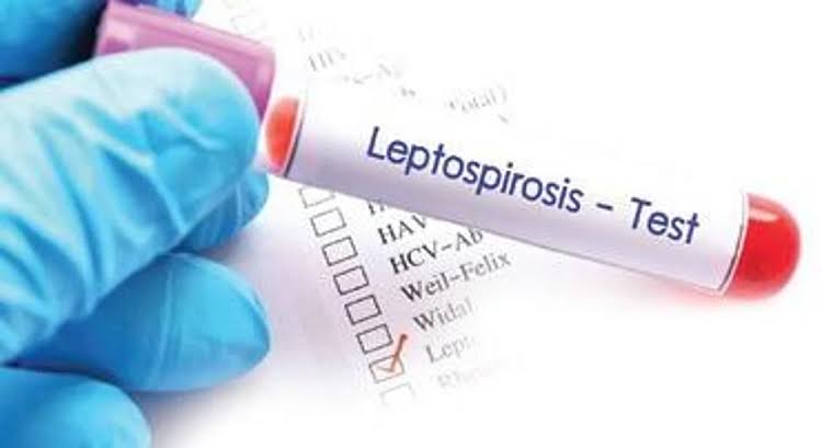 इंजीनियरिंग के 08 छात्रों में हुई लेप्टोस्पाइरा बुखार पुष्टि, कॉलेज बंद